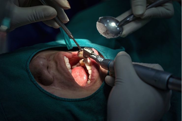 Oral Surgery